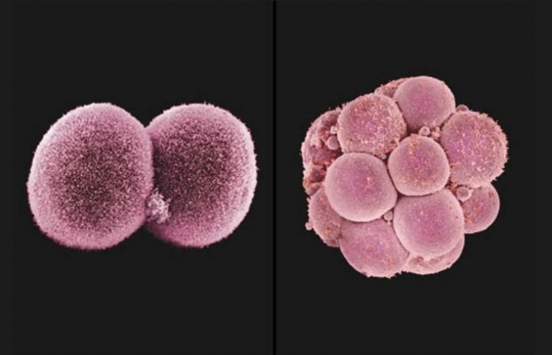 Tế bào gốc biến hình bí ẩn