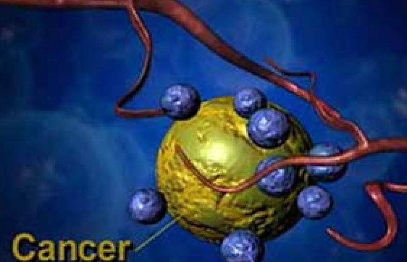 Ngăn ngừa Tế bào gốc Ung thư